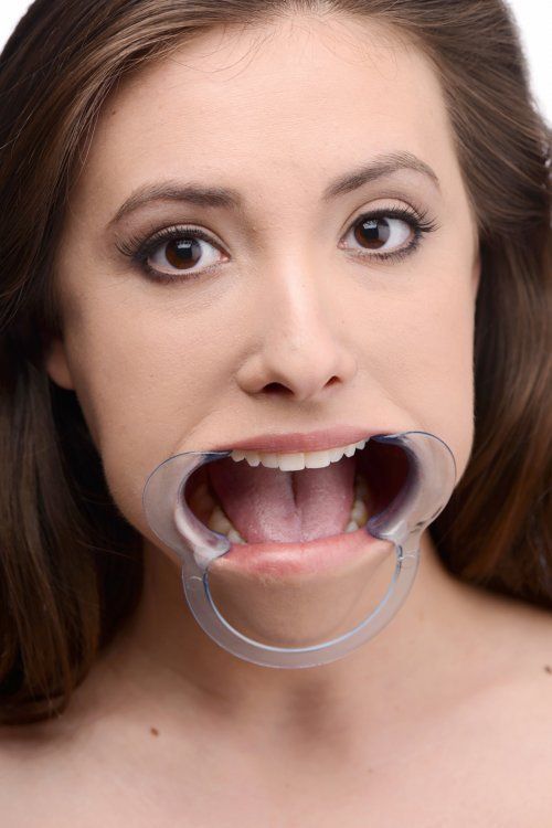 open mouth gag