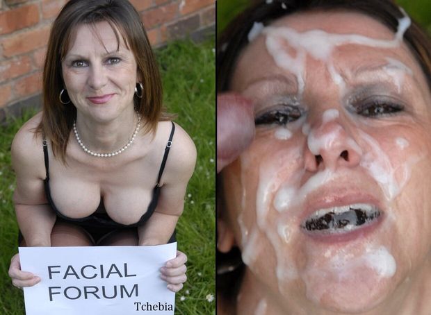 Forum facial Facial: 99,183