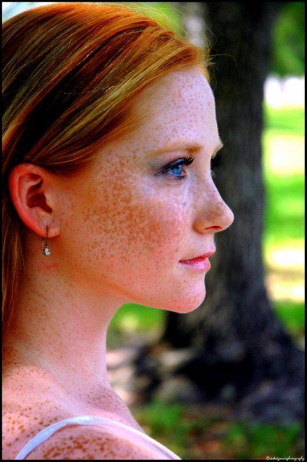 Red hair, blue eyes and freckles