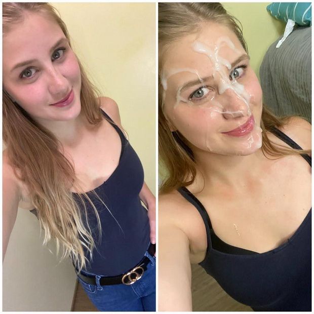 clothed before/after facial