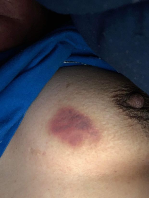 Gave my girlfriend a hickey on her tit she kept moaning while i fingered her wet pussy