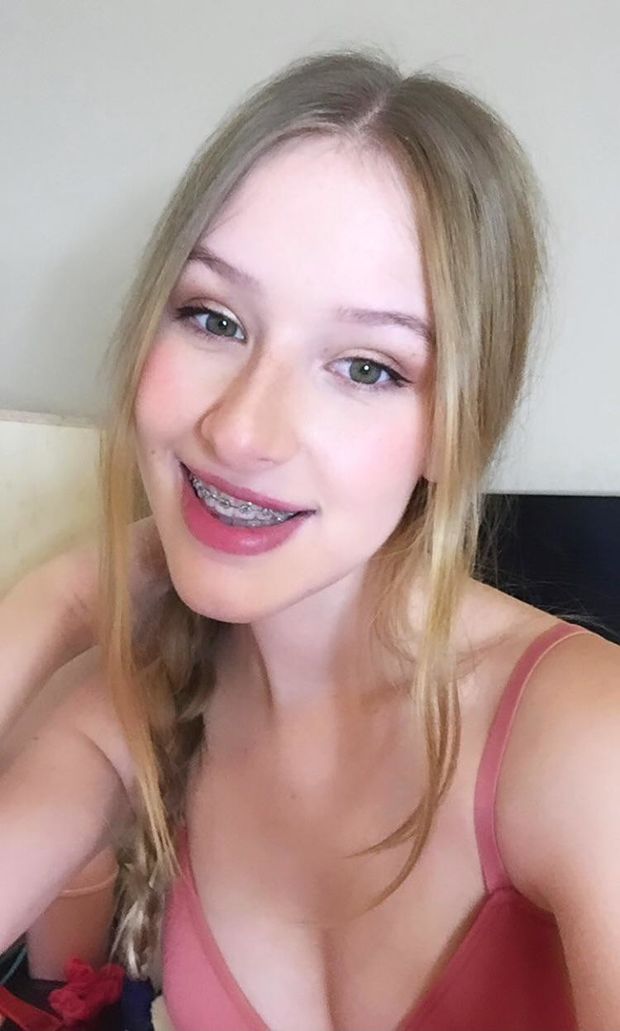 Beauty with braces