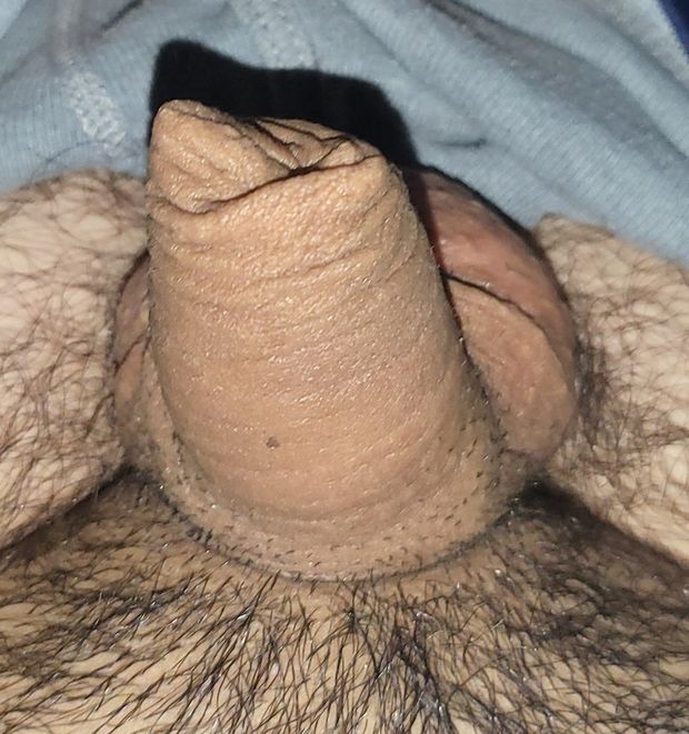 Small uncut penis