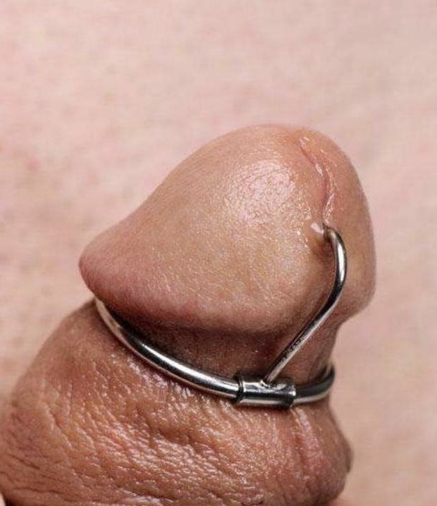 CBT glans ring