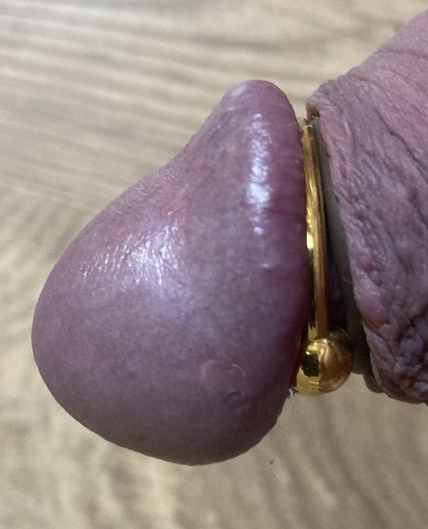 Glans ring swollen cock head